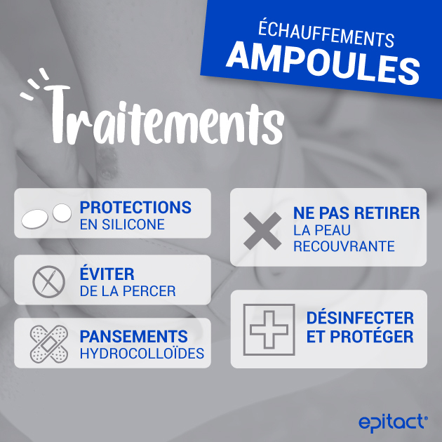 Comment soigner une ampoule au pied ? Que faire en cas d'ampoule